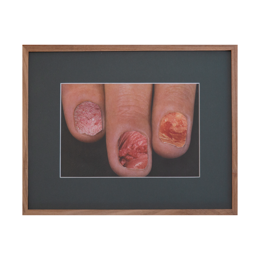 Pins and needles, 2025