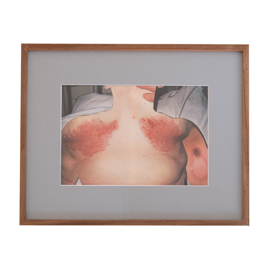 All together at once, 2025