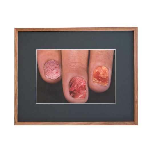 Pins and needles, 2025